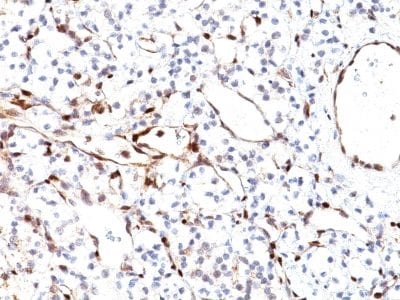 PTEN Monoclonal Mouse Antibody (PTEN/2110)