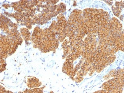 PTH / Parathyroid Hormone Monoclonal Mouse Antibody (3H9)