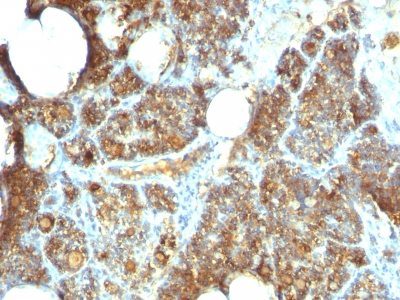 PTH / Parathyroid Hormone Monoclonal Mouse Antibody (PTH/1173)