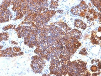 PTH / Parathyroid Hormone Monoclonal Mouse Antibody (PTH/1173)