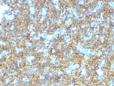 PTH / Parathyroid Hormone Monoclonal Mouse Antibody (PTH/1174)