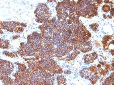 PTH / Parathyroid Hormone Monoclonal Mouse Antibody (PTH/1174)