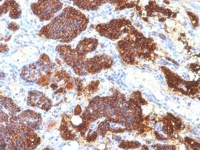 PTH / Parathyroid Hormone Monoclonal Mouse Antibody (PTH/1175)