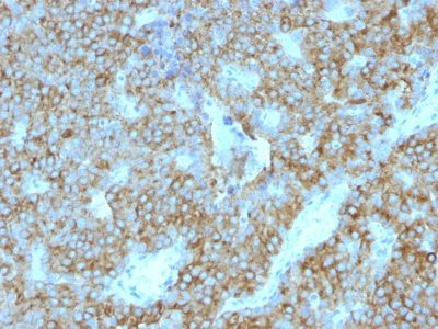 PTH / Parathyroid Hormone Monoclonal Mouse Antibody (PTH/1175)