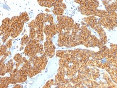 PTH / Parathyroid Hormone Monoclonal Mouse Antibody (PTH/911)