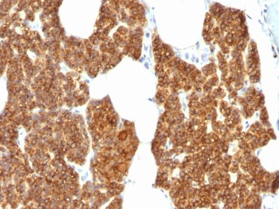 PTH / Parathyroid Hormone Polyclonal Rabbit Antibody