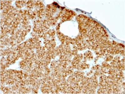PTH / Parathyroid Hormone Recombinant Monoclonal Mouse Antibody (rPTH/911)