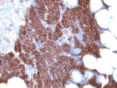PTH Monoclonal Mouse Antibody (3H9 + PTH/1175)
