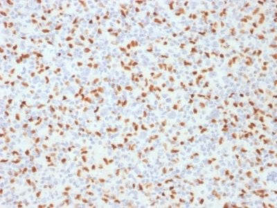 PU.1 Monoclonal Mouse Antibody (PU1/2146)