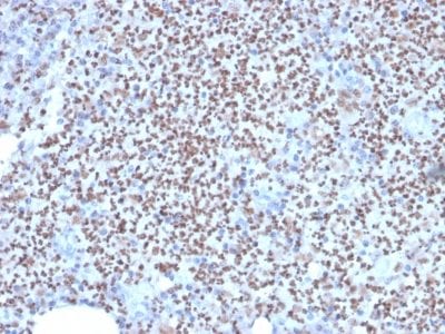 PU.1 Monoclonal Mouse Antibody (PU1/2146)