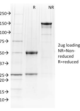 PU.1 Monoclonal Mouse Antibody (PU1/2146)
