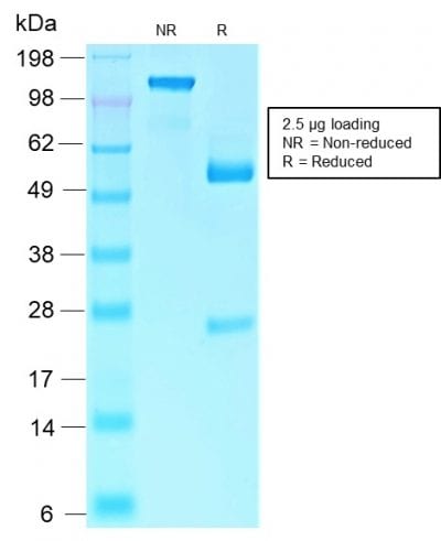 Rb1 Recombinant Monoclonal Rabbit Antibody (RB1/2313R)