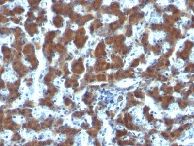 Retinol Binding Protein 1 Monoclonal Mouse Antibody (G4E4)