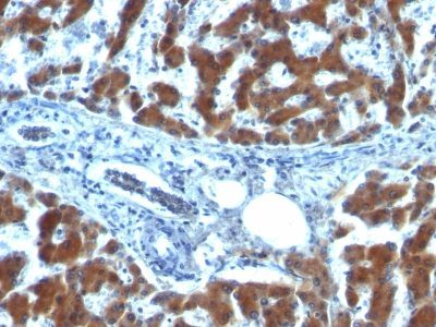 Retinol Binding Protein 1 Monoclonal Mouse Antibody (RBP/872)