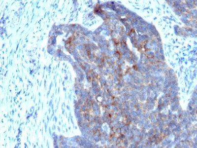 Retinol Binding Protein 1 Monoclonal Mouse Antibody (RBP/872)