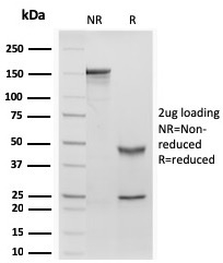 Retinol Binding Protein-1 Recombinant Monoclonal Mouse Antibody (rRBP1/872)