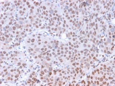 RNA Polymerase II CTD Repeat YSPTSPS Monoclonal Mouse Antibody (CTD 8A7)