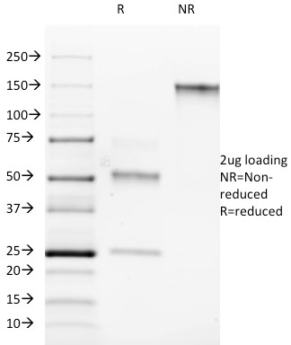 ROR-Gamma / RORC Monoclonal Mouse Antibody (RORC/2942)