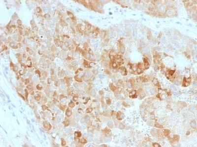 ROR2 Monoclonal Mouse Antibody (ROR2/1911)