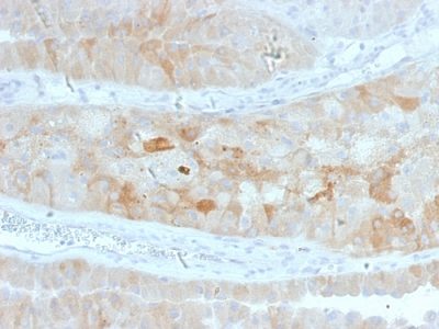 ROR2 Monoclonal Mouse Antibody (ROR2/1912)