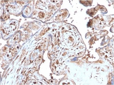 S100A4 Recombinant Monoclonal Rabbit Antibody (S100A4/2750R)