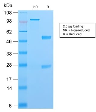 S100A4 Recombinant Monoclonal Rabbit Antibody (S100A4/2750R)