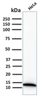 S100A4 Recombinant Monoclonal Rabbit Antibody (S100A4/2750R)