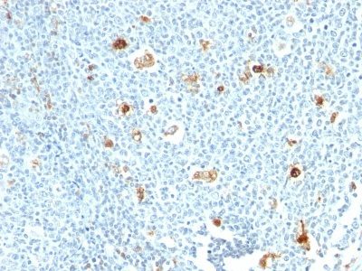 S100A9 Monoclonal Mouse Antibody (CPT/1028)
