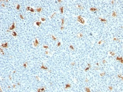 S100A9 Monoclonal Mouse Antibody (S100A9/1011)