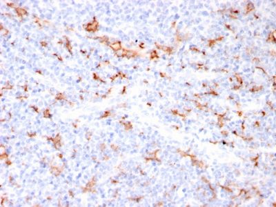 S100A9 Recombinant Monoclonal Rabbit Antibody (MAC3157R)