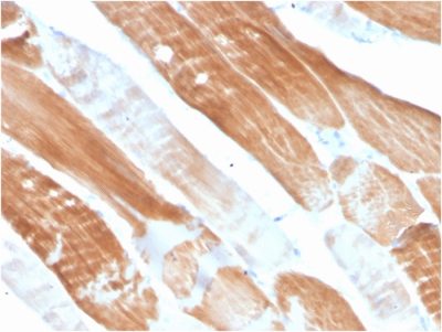 Sarcomeric Actinin Alpha 2 / ACTN2 Monoclonal Mouse Antibody (ACTN2/3291)
