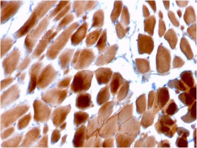 Sarcomeric Actinin Alpha 2 / ACTN2 Monoclonal Mouse Antibody (ACTN2/3292)