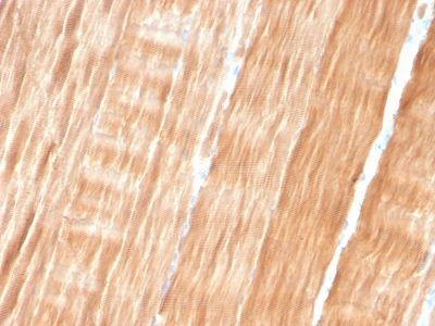 Sarcomeric Actinin Alpha 2 / ACTN2 Monoclonal Mouse Antibody (ACTN2/3293)