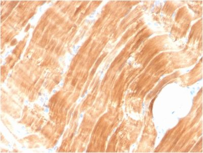 Sarcomeric Actinin Alpha 2 / ACTN2 Monoclonal Mouse Antibody (ACTN2/3294)