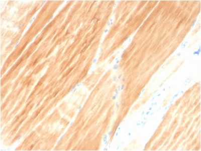 Sarcomeric Actinin Alpha 2 / ACTN2 Monoclonal Mouse Antibody (ACTN2/3295)