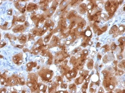 Serum Amyloid A Monoclonal Mouse Antibody (SAA/326)