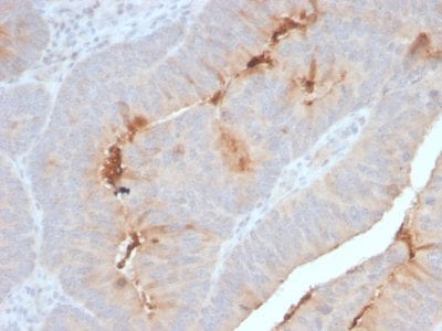 Serum Amyloid A Recombinant Monoclonal Rabbit Antibody (SAA/2868R)