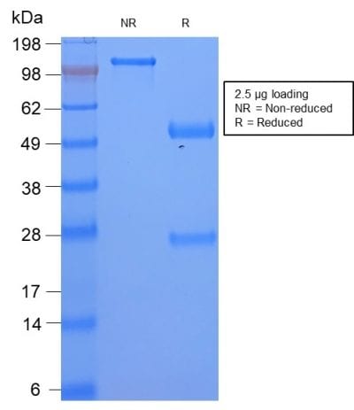 Serum Amyloid A Recombinant Monoclonal Rabbit Antibody (SAA/2868R)