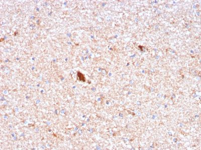 Serum Amyloid P / APCS Monoclonal Mouse Antibody (APCS/3240)