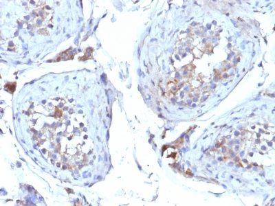 SHBG Monoclonal Mouse Antibody (SHBG/245)