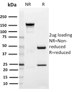 SIGLEC1 / CD169 / Sialoadhesin Monoclonal Mouse Antibody (HSn 7D2)