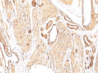 Smooth Muscle Actin Monoclonal Mouse Antibody (1A4)