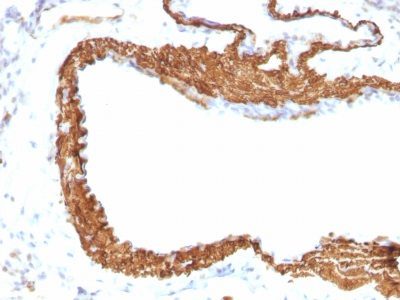 Smooth Muscle Actin Monoclonal Mouse Antibody (ACTA2/791 + 1A4)