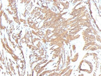 Smooth Muscle Actin Monoclonal Mouse Antibody (ACTA2/791 + 1A4)