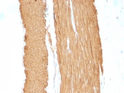Smooth Muscle Actin Monoclonal Mouse Antibody (ACTA2/791 + 1A4)