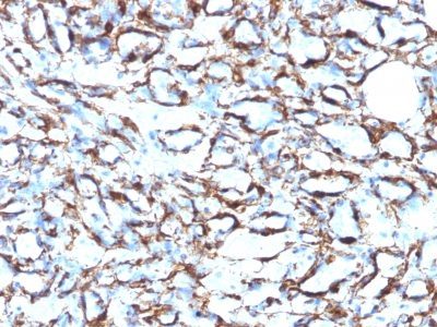 Smooth Muscle Actin Monoclonal Mouse Antibody (ACTA2/791 + 1A4)