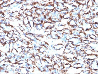 Smooth Muscle Actin Monoclonal Mouse Antibody (ACTA2/791)