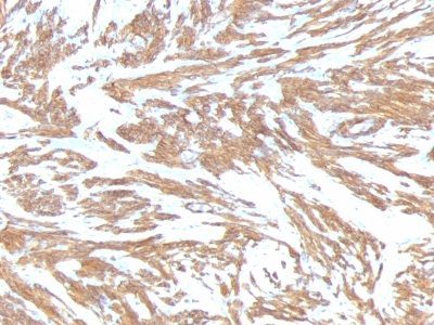 Smooth Muscle Actin Monoclonal Mouse Antibody (ACTA2/791)