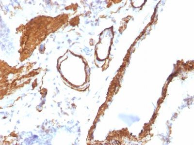 Smooth Muscle Actin Monoclonal Mouse Antibody (ACTA2/791)