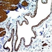 Smooth Muscle Actin Monoclonal Mouse Antibody (ACTA2/791)